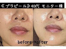 サロンスペースの雰囲気（【プラピーリング】）