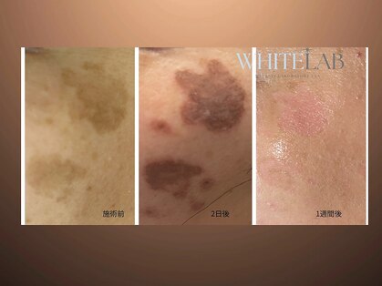 イチ(ICHI)の写真