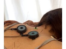 久心宝鍼灸院の雰囲気（肩コリにも◎）