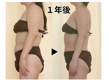 ディアメデル(Diamedel)/