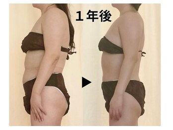 ディアメデル(Diamedel)/