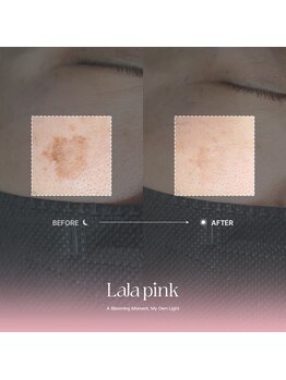 カルム(Calme)/Lalapink