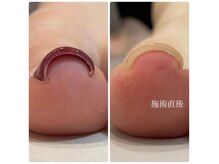モモネイルズ(Momo Nails)の雰囲気（痛い巻き爪でお悩みの方、是非お試しください。）