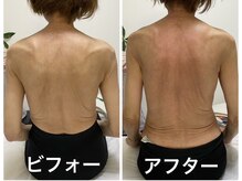 ナオフクオカ ヒーリングフォースエヌ(NaoFukuoka/healingforceN)/背中の痛みや腰痛にも！