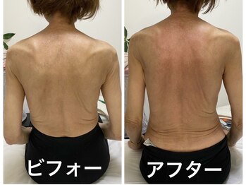 ナオフクオカ ヒーリングフォースエヌ(NaoFukuoka/healingforceN)/背中の痛みや腰痛にも!