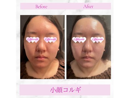 アフロディーテ 横浜(Aphrodite)の写真
