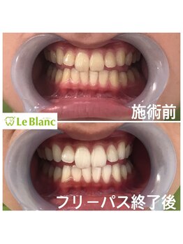 ルブラン 奈良店(Le Blanc)/本日フリーパス終了致しました