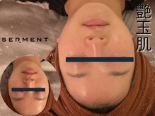 シエスタ(siesta)/セルマン艶玉肌トリートメント