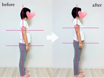 エーアール(AR)/【Before/After】