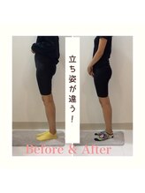 スタイルラボ高松/骨盤矯正の効果♪