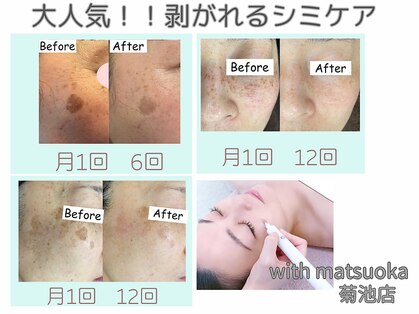 ウィズマツオカ 菊池本店の写真