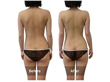 ベンザイ 梅田店(BENZAI)/整体感覚で月１メンテナンス