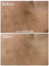 ルタンリッシュ ハナレ(Lutan Riche 花麗)/