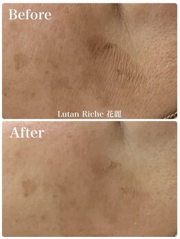 ルタンリッシュ ハナレ(Lutan Riche 花麗)/