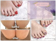 ≪１回でツルツル!》自分じゃできない本格ケアがセットでお得☆