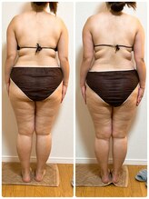 ソレイユ 北千住店(soleil)/全身の変化が分かる比較写真(3)