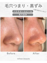 ミハン ボーテ(mihan.beaute)/