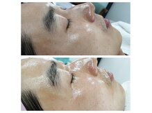 ココ(COCO)の雰囲気（渡韓不要の水光ツヤ肌◆痛み、ダウンタイムなしの施術◎）