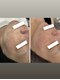 サロン ド ビューティージュエル(salon de beauty JEWEL)の写真/シミには種類があります。だから毎回同じ施術はしません。