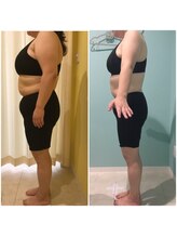 エステティックサロン ピュール ボーテ 東金店/運動なし　ｂｓｐダイエット★☆