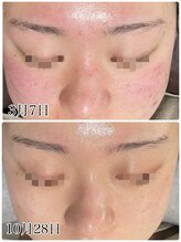 アイルーム(i.room)/