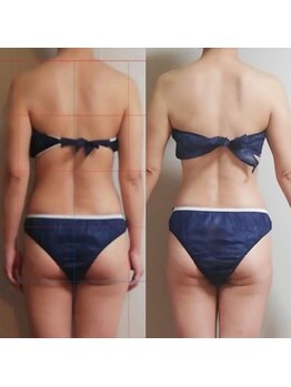 スーピー(SuuuPeee)/【オイル全身筋膜リリース】