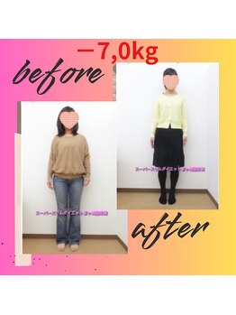 スーパースリムダイエット茅ヶ崎 茅ヶ崎整体院/2ヵ月－7ｋｇ減ダイエット♪