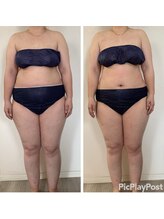 アンリ(Anli)/痩身1ヶ月