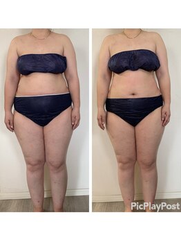 アンリ(Anli)/痩身1ヶ月