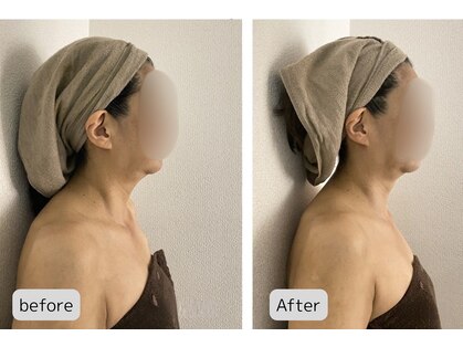 オトサロン(Otosalon)の写真