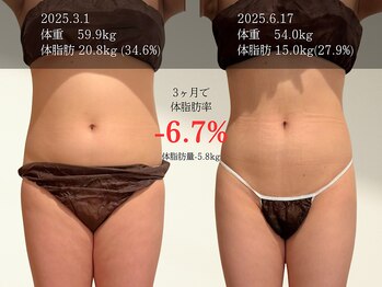 マルノウチ サロン(MARUNOUCHI salon)/20代後半のお客様/3ヶ月 加藤