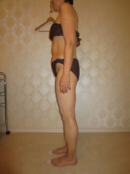 ルメートルセラピー ビューティーサロン(REMETTRE THERAPY)/60代ダイエット痩身成功例