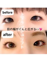 リル(Rire)/上下ラッシュリフト