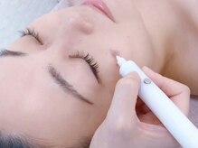 サロンドベルム(Salon de BELME)の雰囲気(当日からメイクOK★ 季節問わず受けられるシミケア)