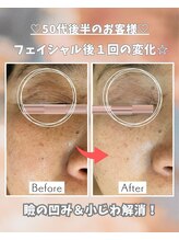 エステサロン 凛/くすみも小じわもスッキリ！