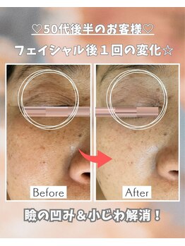 エステサロン 凛/くすみも小じわもスッキリ!