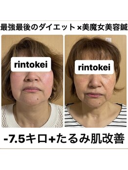 凛と慶/最強ダイエット×美容鍼