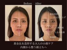 ラ アクサル(la.akthar)の雰囲気（全身・小顔の当サロンの看板メニューです！根本の土台から。）