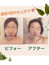 ネイチャー 新高円寺店(nature.)/別人級★小顔フェイシャル