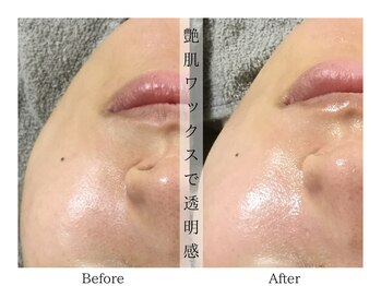 リララ(lelala)/艶肌ワックス×磁気パックの効果