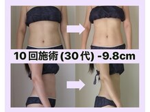 お腹もスパルタ!! 次はあなたの番です!!【町田痩身】