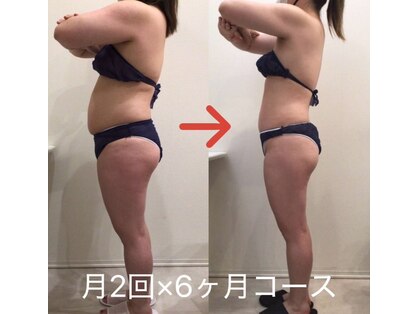 ミール(Meel)の写真