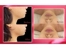 ビオトナス(Facial Esthe)の雰囲気(レモンより圧倒的な輪郭美肌美人!最先端輪郭形成レッドショット)
