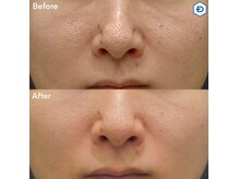 ウェルビーイング(well-being)の雰囲気（韓国肌管理　最新マシンでの毛穴洗浄ヘッドマッサージ付き）