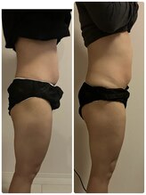 クー(9 Kuu)/痩身◇フォースカッター初回効果