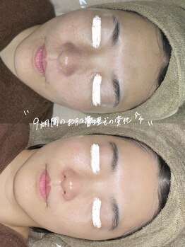 ベル(Belle)の写真/日々頑張りすぎてしまうアナタに。月に1回の自分ケアで前向きで明るい毎日を過ごしてみませんか？