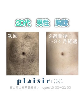 プレジール 富山店(plaisir)の写真/【メンズ・キッズもOK】細い毛~太い毛までしっかり抜ける!毛質を選ばない圧倒的脱毛力でツルスベ肌☆