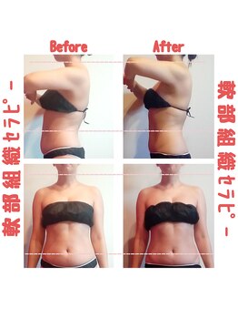 ビューティサロン キヨの部屋(beauty salon)/【軟部組織セラピー】　１回