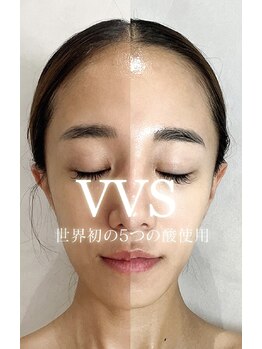 ロイヤル(ROYAL)/VVSダイヤモンドピーリング