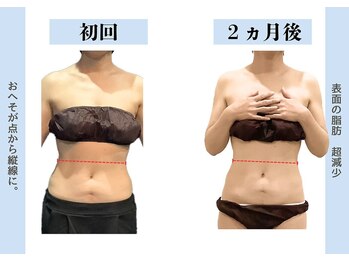 ビオラス 太田藤阿久店/骨盤矯正で更にスタイルアップ！